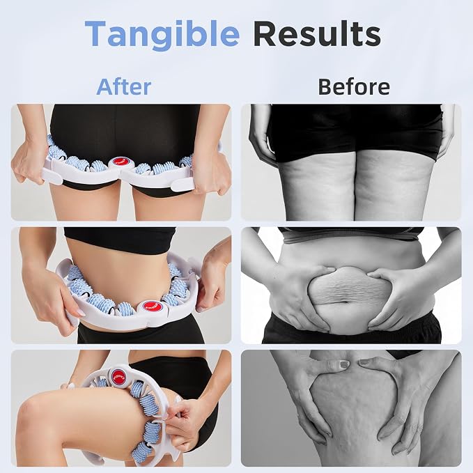 Cellulite Massage Tool - Image 2