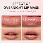 SPODARE Grape Lip Mask, Hydrating Overnight Lip Sleeping Mask, Lip Moisturizer - Image 5