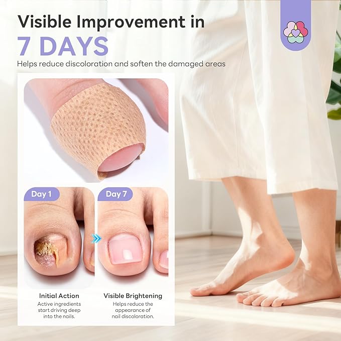 SAVILAND Extra Strength Fungal Nail Patches: 64 Pcs Overnight Repair 1% - Image 5