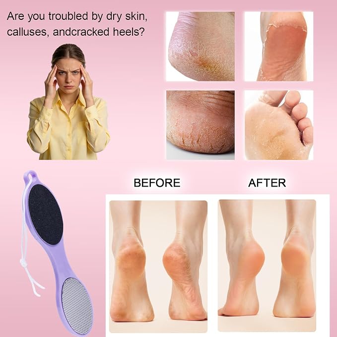 4-Sided Nano Glass Foot Callus Remover, Professional Foot File, Durable Foot - Image 2