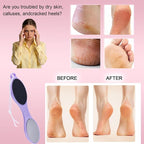 4-Sided Nano Glass Foot Callus Remover, Professional Foot File, Durable Foot - Image 2