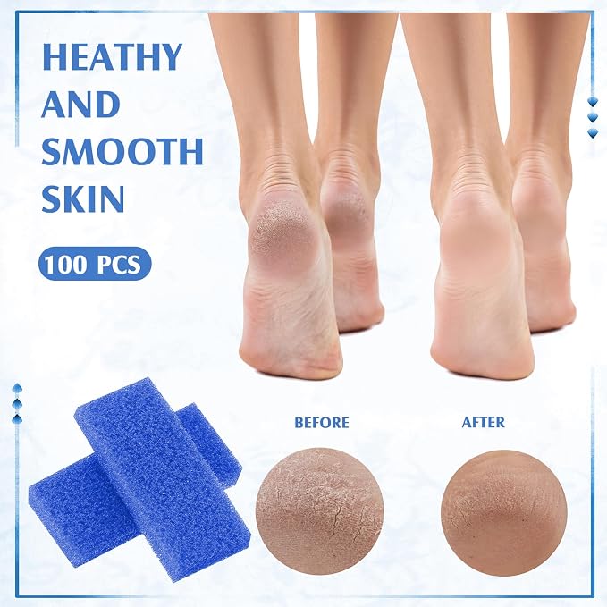 Batiyeer 100 Pcs Pumice Stone for Feet Scrubber Dead Skin Disposable Foot - Image 4