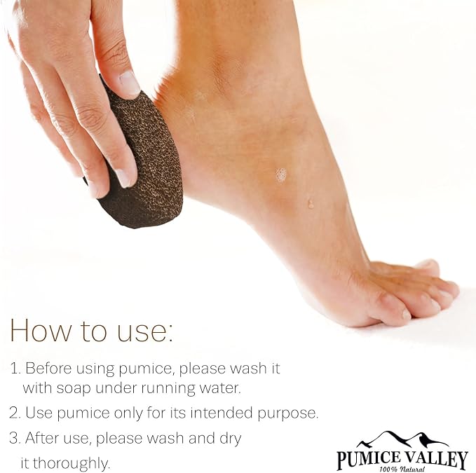 Pumice Stones for Feet - Image 4