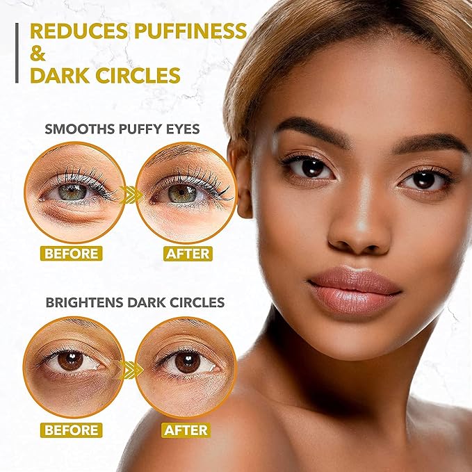 Arvesa Under Eye Mask for Dark Circles and Puffiness, 24k Gold Under Skincare - Image 4