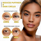 Arvesa Under Eye Mask for Dark Circles and Puffiness, 24k Gold Under Skincare - Image 4