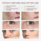Glycolic Acid Toner: 240ml Glycolic Acid 7% Exfoliating Toner Toning Solution - Image 3