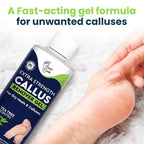 Callus Remover for Feet with Extra Strength Gel & Foot Pumice Stone Set - Image 6