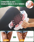 ONUEMP Cellulite Massager Roller, Cellulite Remover Muscle Roller, Fascia - Image 3