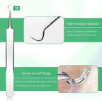 5PCS Blackhead Remover Comedone Extractor, Curved Blackhead Tweezers Kit - Image 3