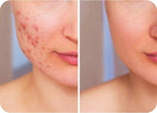 Hypochlorous Acid Spray for Face, Skin & Eyelids – pH-Balanced HOCl Facial - Image 7