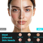 Face Scrubber Facial Cleansing Brush - Image 5
