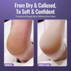 Footlogix Foot Care Callus Softener Combo - Image 6