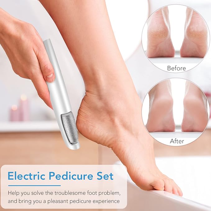 LINKEVAP Electric Callus Remover - Image 2