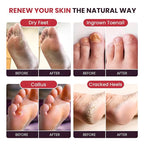 FOOT CURE Tea Tree Oil & Muscle Foot Soak - Image 5