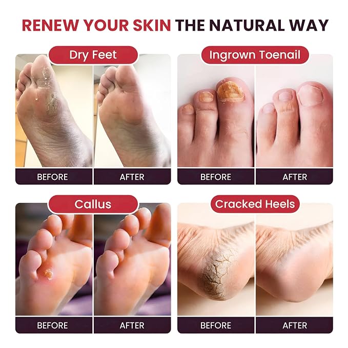 FOOT CURE Tea Tree Oil & Muscle Foot Soak - Image 5