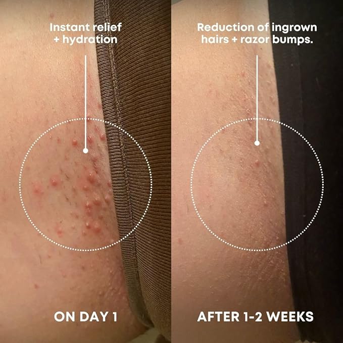 Bushbalm Ingrown Hair Exfoliating Scrub – Pre-Shave Sugar Scrub - Image 2