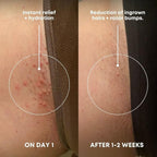 Bushbalm Ingrown Hair Exfoliating Scrub – Pre-Shave Sugar Scrub - Image 2