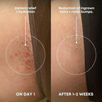 Bushbalm Ingrown Hair Exfoliating Scrub - Image 2