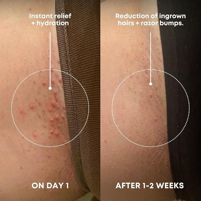 Bushbalm Ingrown Hair Exfoliating Scrub - Image 2