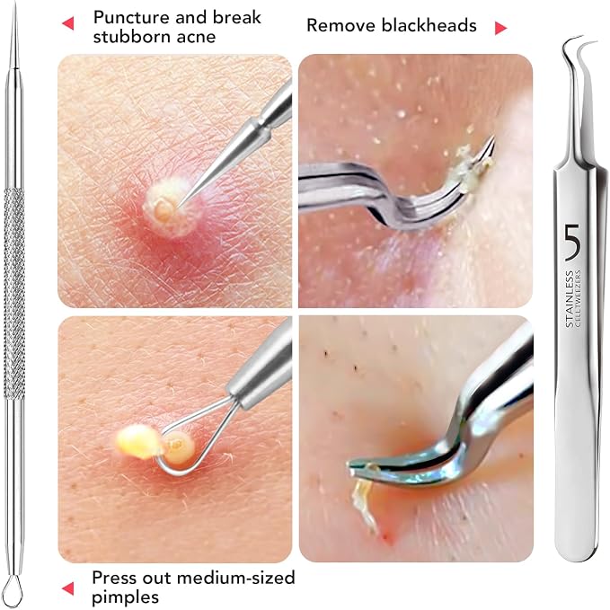 Litbear 6 Pcs Blackhead Remover Tools, Pimple Popper Tool Kit, Acne Tools - Image 5