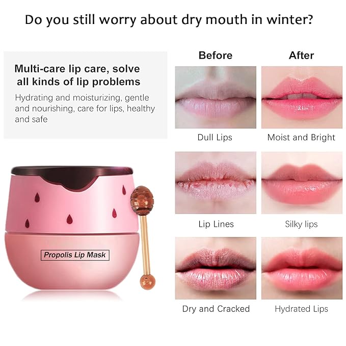 2PCS Bee Lip Balm Honey Pot - Image 4