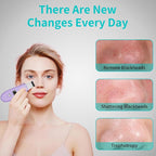 Face Scrubber Skin Spatula - Image 7