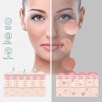 Winado 2 in 1 Professional Facial Steamer - Image 8