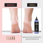Facón Professional Callus Remover Gel - Image 3