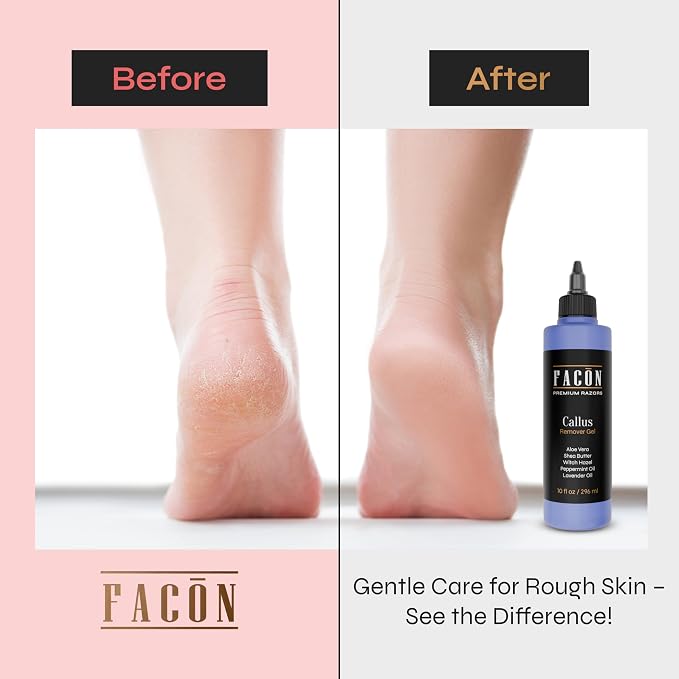Facón Professional Callus Remover Gel - Image 3