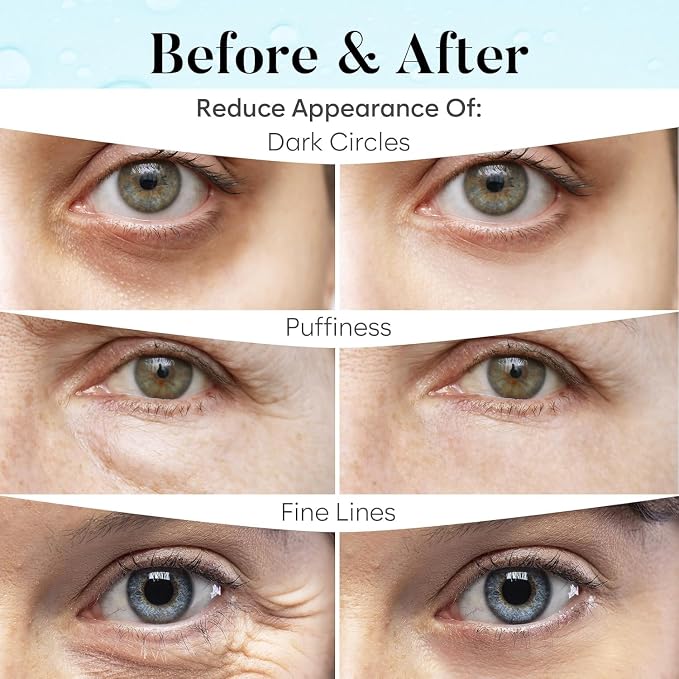 BLOOMORA Retinol & Collagen Under Eye Patches, Under Eye Mask - Image 4