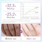 Chicwe 6 Pairs of Hand Masks Moisturizing Glove, Hydrating Hand Masks - Image 3