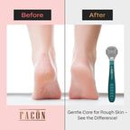 Facón Professional Callus Shaver Remover - Image 3