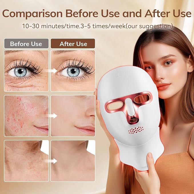 ONLUKY Red Light Therapy Mask for Face, Cordless LED Face Mask Light Therapy - Image 3