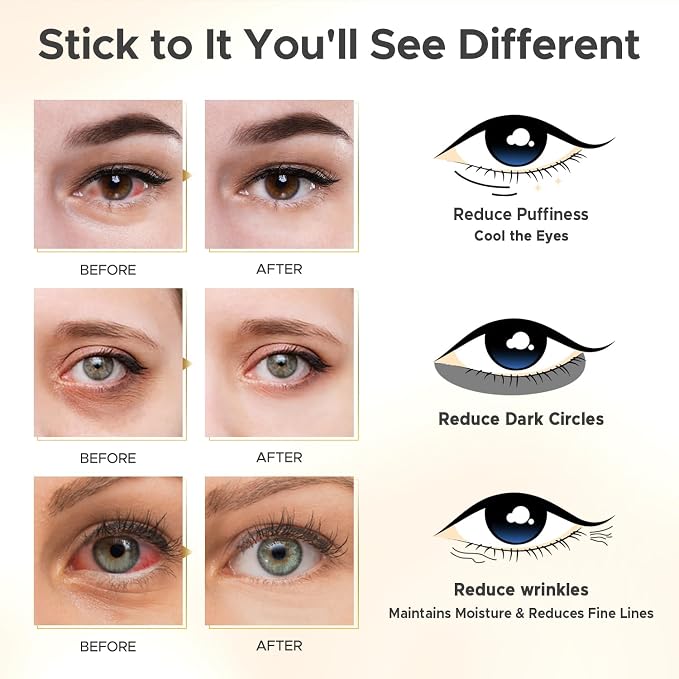 Under Eye Patches for Puffy Eyes, Dark Circles, Wrinkles & Eye Bags-Day & Night - Image 4