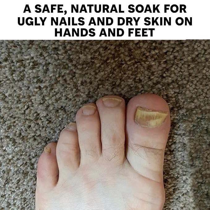 Long Creek Herbs Nail Soak - Image 6