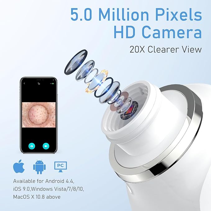 Facial Pore Blackhead Remover Vacuum, 1080P Camera Blackhead Remover, 20x Zoom - Image 5