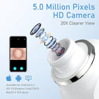 Facial Pore Blackhead Remover Vacuum, 1080P Camera Blackhead Remover, 20x Zoom - Image 5