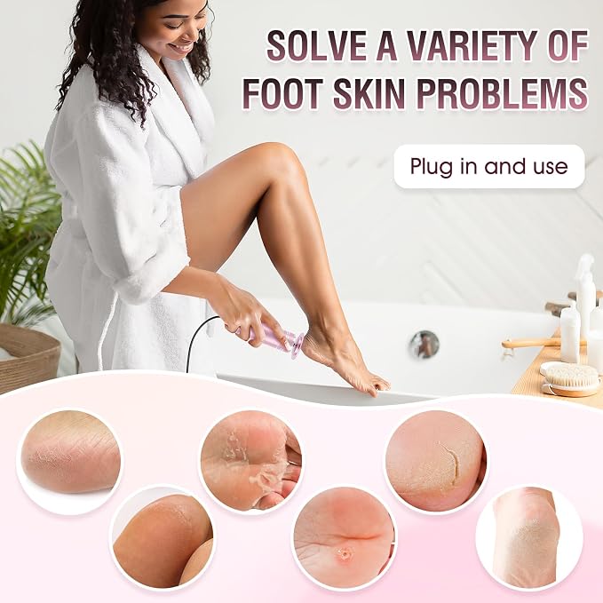 Electric Foot File Callus Remover: Adjustable Speed 1000RPM Feet File Grinder - Image 4