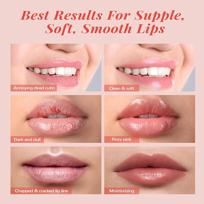Hydrating Lip Mask Set, Lip Scrub & Lip Butter, Overnight Lip Treatment Set - Image 4