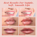 Hydrating Lip Mask Set, Lip Scrub & Lip Butter, Overnight Lip Treatment Set - Image 4