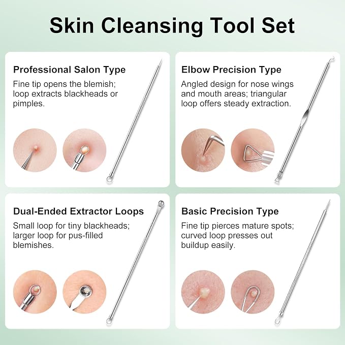 Blackhead Remover Tools for Face, 304 Stainless Steel Pore Extractor Spatula - Image 5