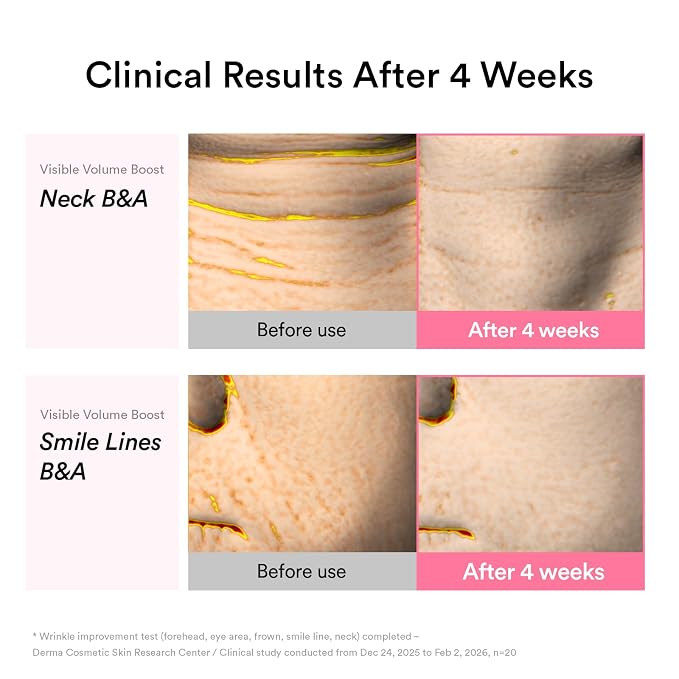 Abib PDRN Volume fill-it Booster Cream 2.5 tube | Facial Volume Plumping - Image 6