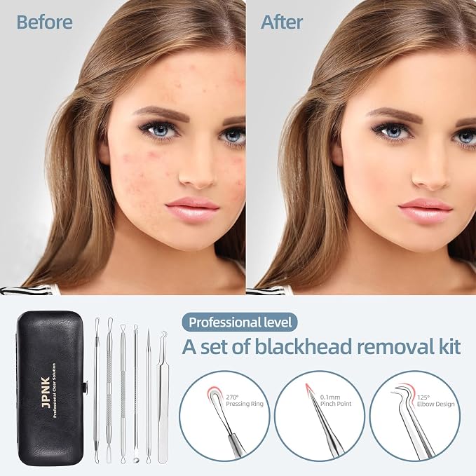 JPNK Blackhead Remover Comedone Extractor Acne Removal Kit.. - Image 2