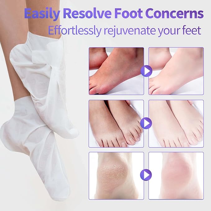 5 Pack Moisturizing Foot Mask, Hydrating Foot Masks - Image 4