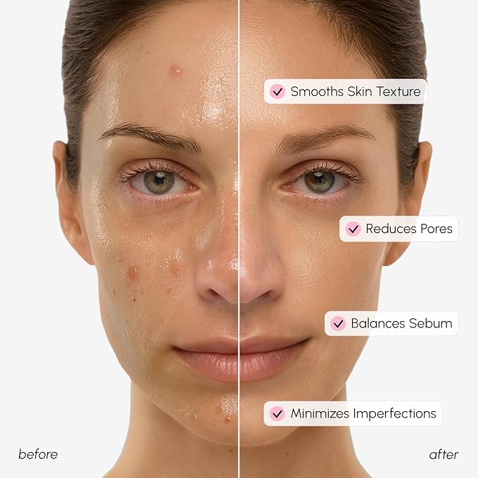 MAREE Pore Minimizer for Face Toner – Witch Hazel Toner - Image 4
