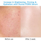 Salmon DNA PDRN Anti-Aging Serum, 5000ppm Salmon Egg DNA Ampoule, 2000ppm - Image 4