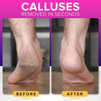 RUSTPROOF Foot File Callus Remover - Image 2