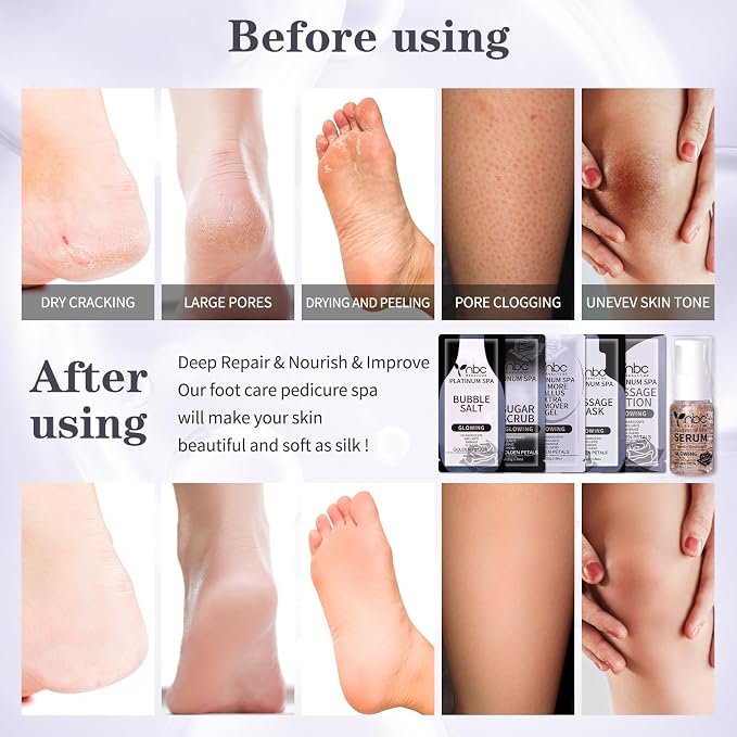 Pedicure Foot Soak Set - Image 3