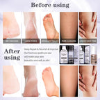 Pedicure Foot Soak Set - Image 3
