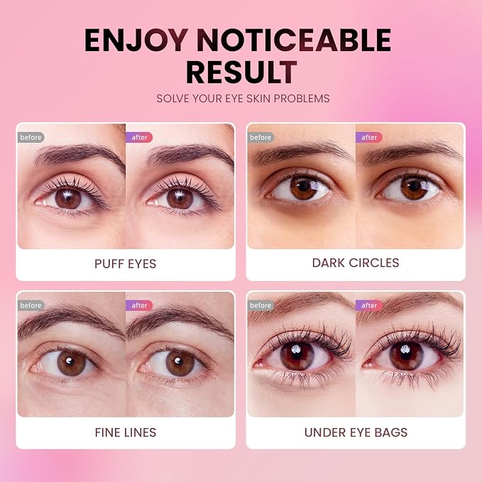 AILEORY Under Eye Patches - Image 5